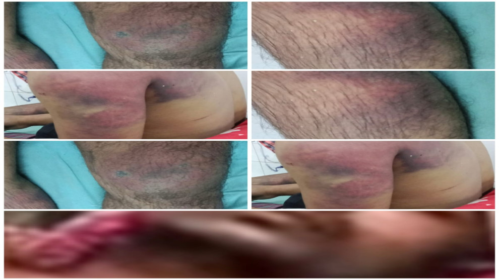 ইসলামপুরে নির্যাতনের শিকার সেলিম বাবুর অবস্থা আশঙ্কাজনক!যে কোন সময় পাওয়া যেতে পারে অনাকাঙ্ক্ষিত সংবাদ