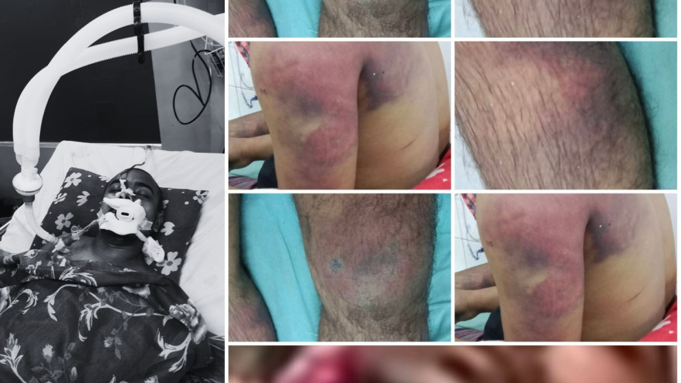 ইউপি মেম্বারের পৈশাচিক নিষ্ঠুরতার শিকার সেলিম বাবু চিকিৎসাধীন অবস্থায় মৃ/ত্যু