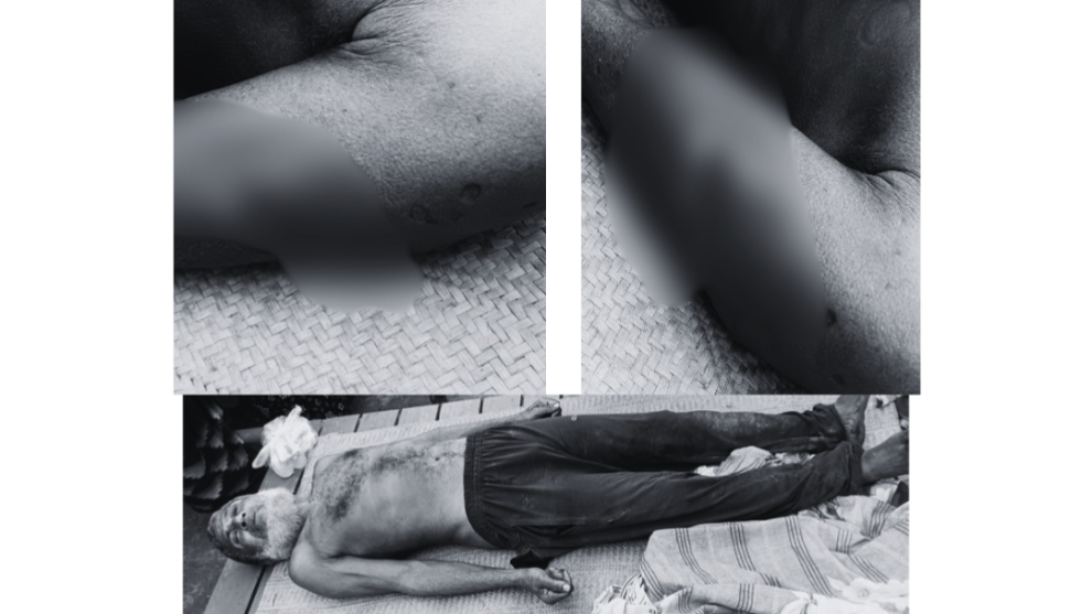 শার্শায় বিদ্যুৎস্পৃষ্ট হয়ে কৃষকের মৃত্যু