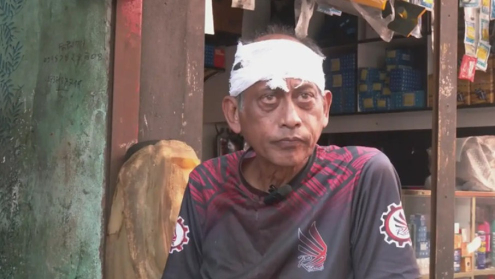 যশোরে বাড়ির সামনে হামলার শিকার অভিনেতা সমু চৌধুরী, মাথায় ৪ সেলাই